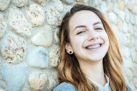 Looking To Get Braces In Tucson