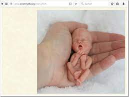 Baby 11 Wochen Perry Platyphus