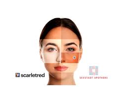 Scarletred Expands its AI-Powered Consultation Service at Seestadt Apotheke  in Vienna: Choosing the Right Sunscreen for Your Skin Type Can Prevent Skin  Damage