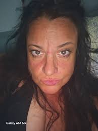 Lupus??...is it LUPUS??!?!??😳