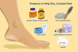 The skin on the soles of our feet are prone to hyperkeratosis, or skin thickening, to protect it i love applying a thick layer of urea cream to my feet overnight and wrapping them in saran wrap, she this peel also comes with supercute socks to wear during the treatment process, which can last up. Coping With Dry Skin And Cracks On Your Feet