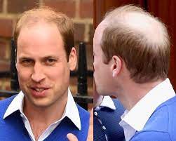 Pin On Hair