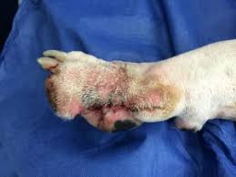 Image result for toe amputation