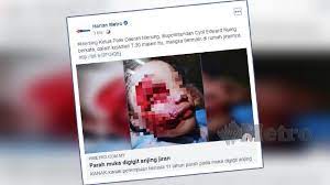 Polda metro jaya akan patroli bubarkan kerumunan di zona oranye dan merah idi: Jpv Siasat Kes Anjing