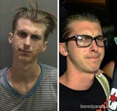 Meth causes many users to feel a crawling sensation under their skin (called formication), causing. 24 Stunning Before After Transformations Of People Who Quit Drugs Bored Panda