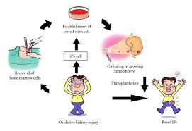 Figure 4 Potential Use Of Stem Cells For Kidney Regeneration Medically reviewed by christina chun, mph — written by mary ellen ellis a nephrectomy is a major surgery to remove all or part of your kidney. stem cells for kidney regeneration