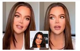Khloe Kardashian Accused Of Getting A Nose Job As She Looks Totally Different In Video Celebrating