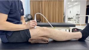 パテラ セッティング と は