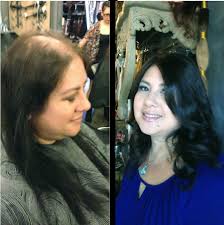 Sac Dokulmesini Onleyen Dogal Tarif Dogal Sac Bakimi Dogal Sac Sac Dokulme Tedavileri