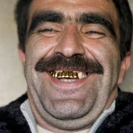I denti dei Rom