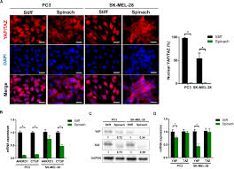 Discover microbiology solutions for diagnosis of infectious disease and detection of bacterial contamination in industrial applications. Frontiers Plant Based Scaffolds Modify Cellular Response To Drug And Radiation Exposure Compared To Standard Cell Culture Models Bioengineering And Biotechnology