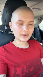 this + the one arm makes me feel like a zoo exhibit #cancer