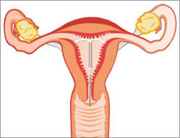 Intrauterinpessar Kupferspirale Familienplanung Verhutung Frauenarzte Im Netz Ihr Portal Fur Frauengesundheit Und Frauenheilkunde