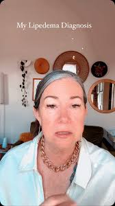 My Lipedema Diagnosis , I met with Dr Jessica Mintz yesterday at Lahey  Hospital in Massachusetts 781-744-8460, She confirmed I indeed do have  Lipedema. I don’t have lymphedema so that was a relief to ...