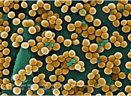 Cosa sono le infezioni da stafilococco? Mrsa Stafilococco Resistente Alla Meticillina