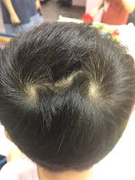 546 results for hair swirls. So My Son Has Three Whorls On His Head Mildlyinteresting