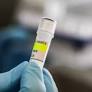 France Begins Reinforced Quarantines Amid Hantavirus Concerns
