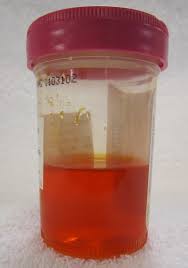 Whats The Normal Color Of Dog Urine Dog Discoveries