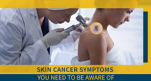 It can be in situ which means that the cancer is confined to the top layer of skin, thus being highly curable. Skin Cancer Symptoms You Need To Be Aware Of