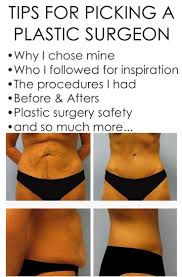 Picking A Plastic Surgeon In 2020 Plastic Surgeon Skin Removal Surgery Mommy Makeover Surgery