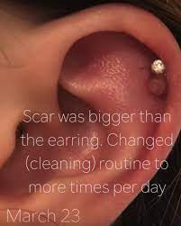 Scaffolding Piercing Bump