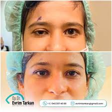 Op. Dr. Evrim Tarkan