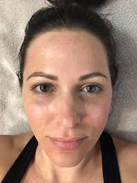 Mandy Ramer, NP-C додаде нова фотографија.