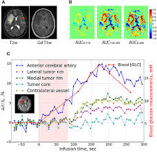 Pixel experience 11 development and porting is a. Frontiers Non Invasive Investigation Of Tumor Metabolism And Acidosis By Mri Cest Imaging Oncology