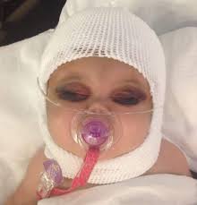 Bailey's Blessings and Battles (@baileysblessingsbattles) • Facebook