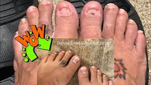 Toe nails white acrylic toe nails nails after acrylics pretty toe nails white toes cute toe nails pink toes pretty toes white pedicure. Toe Nail Extreme Transformation Dual Forms White Tip White Moon Acrylic Toenails Youtube