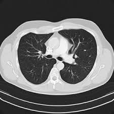 Computertomographie Ct Diagnostikum Berlin