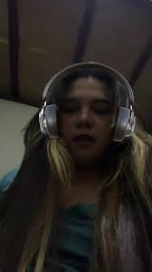 Darly Sanchez Amputee