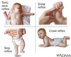 Newborn Reflexes Nursing Assessment And Care