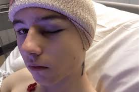 Sheffield teenager who had brain tumour removed last Christmas launches new  appeal