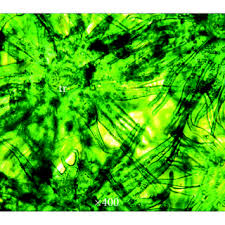 Image result for Phragmanthera capitata