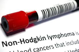 Although there is no screening test for the disease, minimizing risk. Blood Cancer Survival Rates In Canada On The Rise Report Finds Rci English