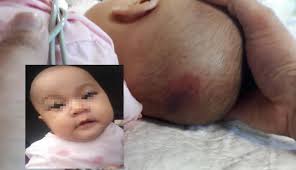 Punca kematian bayi malang, adam rayqal dipercayai akibat 'head injury due to blunt force trauma' atau trauma di kepala kerana hentakan menggunakan objek tumpul. Kes Adam Rayqal Buat Wanita Ini Tuntut Keadilan Demi Aisy Semasa Mstar