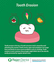 Dental Clinic In Chennai Best Dental Hospital Laser Dental Treatment Dental Implants Dental Dental Crowns Dental Implants Infographic