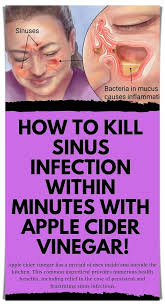 Kill Sinus Infection Within Minutes With What You Have In Your Kitchen Sinus Infection Sinusitis Sinus Infection Remedies