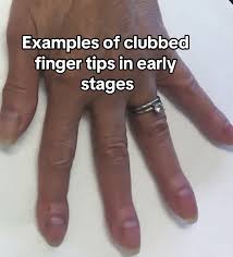 Image result for Digital Clubbing