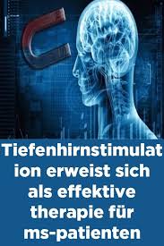 tiefenhirnstimulation erweist sich als effektive therapie fur ms patienten health movie posters