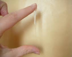 In einigen fällen kann schleim im stuhl das symptom einer ernsten oder gefährlichen erkrankung sein, die unverzüglich abgeklärt werden muss. Zervixschleim