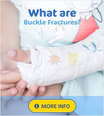 Maybe you would like to learn more about one of these? Wrist Supports For Buckle Fractures Wristsupports Co Uk