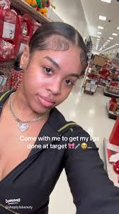 Lip Fillers at Target: My Experience & Tips 💉