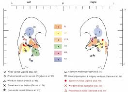 8 these simple hallucinations localize fairly reliably to the heschl gyrus, the primary auditory sensory area. 1 Primary Auditory Cortex A1 And Five Areas Of Non Primary Auditory Download Scientific Diagram