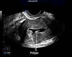 Pin On Ob Gyn Ultrasound 101 Mod 2