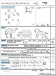 Maybe you would like to learn more about one of these? Moca Scoring Nuances With Clock Draw Clock Drawing Test Cdt Download Scientific Diagram Tabrak Warga