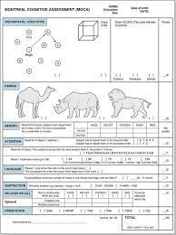 Moca scoring nuances with clock draw : Moca Scoring Nuances With Clock Draw Clock Drawing Test Cdt Download Scientific Diagram Tabrak Warga