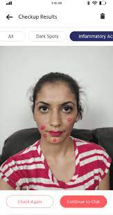 Personal skin advisors available 24/7 over chat! Skin Doctor Near Me Consult With Best Dermatologists Online