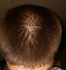 Check out my full guide on how to stop hair loss and regrow your hair naturally. I M 20 Why Does My Hair Look So Thin Hair Beauty Skin Deals Me Fashion Love Cute Style Women Makeup Hair Looks My Hair Hair